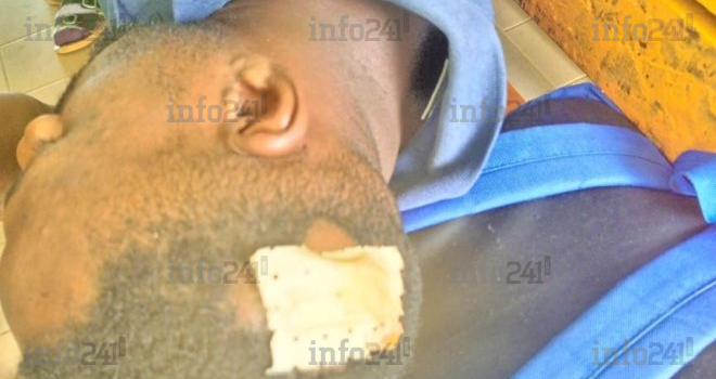 Oyem&nbsp;: Une rixe entre 3 jeunes gabonais pour de la bière volée finit à l’hôpital et à la DGR&nbsp;!