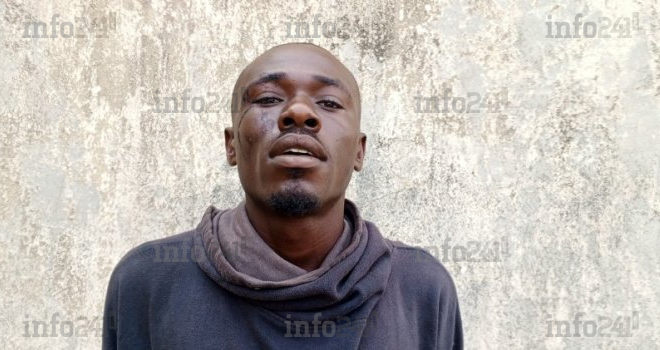 Pour une dette de 6 000 FCFA, un jeune gabonais arrache aux dents, une oreille à son pote